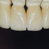 Panetas Dental Products